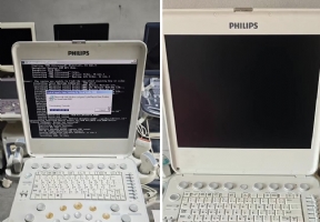 Philips CX-50 portable ultrasound