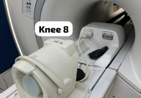Knee 8ch