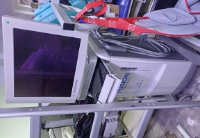 Medtronic FUSION ENT Navigation