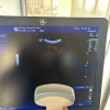 GE Logiq P5 convex ultrasound probe 4C