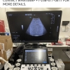 GE Logiq fortis R3